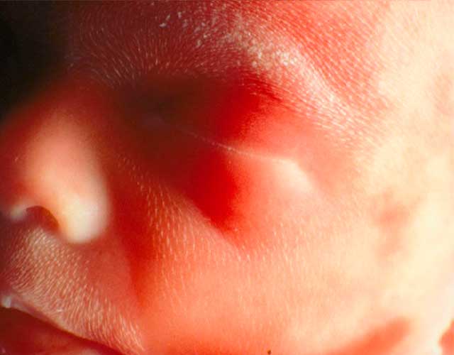 El lanugo del feto, desarrollo durante el embarazo
