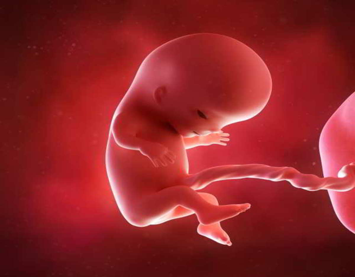 Плод 11 недель фото. Эмбрион человека 11 недель. Зародыш человека 10 недель.