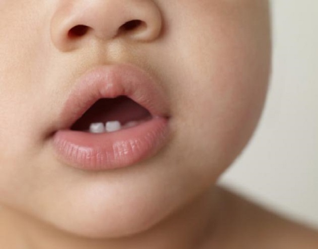 El dolor de los dientes en niños