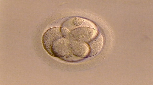 Tratamiento de fertilidad, inseminación artificial