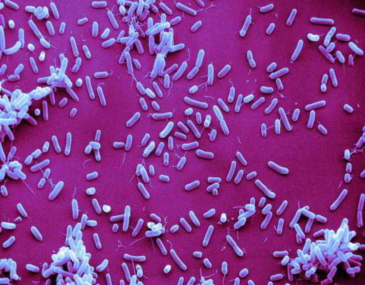 Haemophilus influenzae b. Бактерии Haemophilus influenzae. Гемофильная инфекция возбудитель. Гемофильная палочка микроскопия. Гемофильная палочка микробиология.