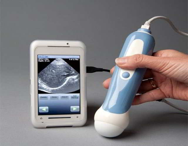 ultrasonido-embarazadas-smartphone