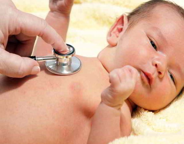 bebés con meningitis