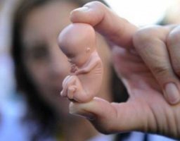 ¿Cuáles son las técnicas para inducir el parto?