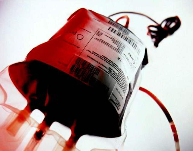 donar sangre embarazada se puede hacer