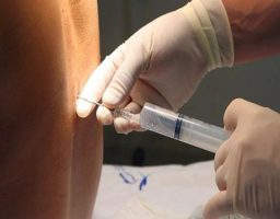 anestesia raquídea