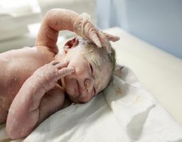 Vernix caseoso