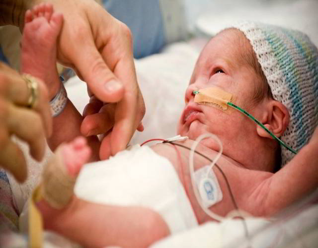 Cuáles son las complicaciones del recién nacido prematuro