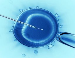 Transferencia intratubárica de cigotos (TIC)