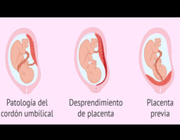 Factores De Riesgo De La Muerte Fetal