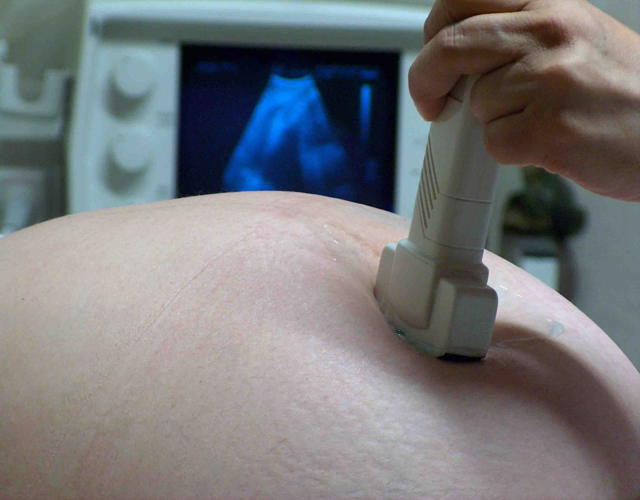 Cómo afecta el sobrepeso de la madre al embrion