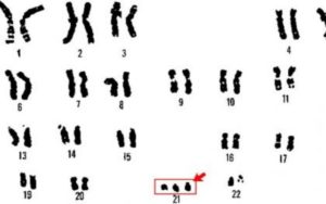 Pruebas Para Detección De Anomalías Cromosómicas