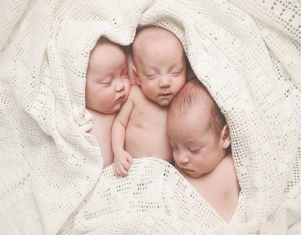 Tipos de embarazo gemelar triple