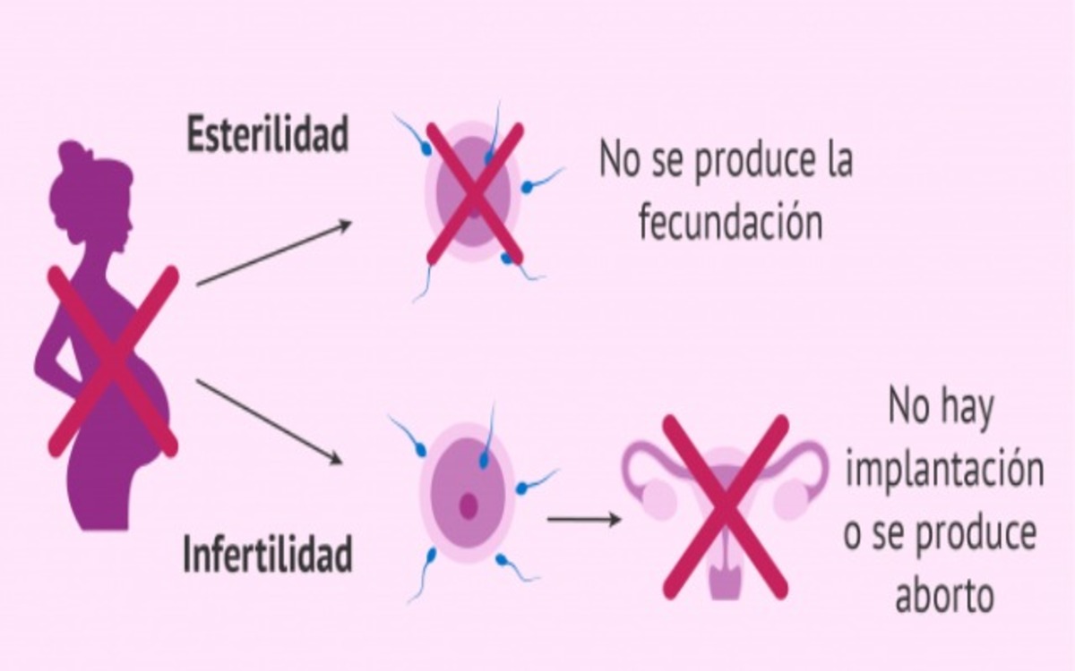 Diferencias Entre Esterilidad E Infertilidad